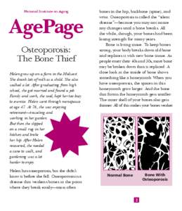 Aging-associated diseases / Eli Lilly and Company / Drugs / Osteology / Osteopathies / Osteoporosis / Bone / Osteopenia / Teriparatide / Medicine / Health / Anatomy