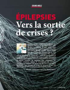 grand angle  ➜ épilepsies