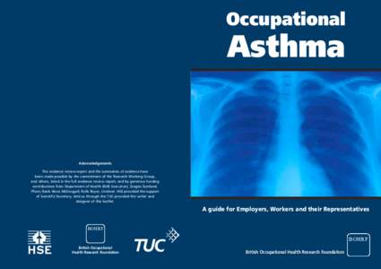 Occupational  Asthma Acknowledgements The evidence review report and the summaries of evidence have