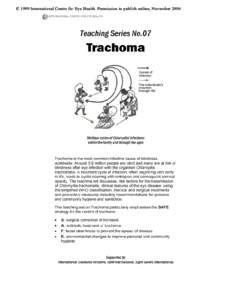 Ophthalmology / Sexually transmitted diseases and infections / Tropical diseases / Blindness / Trachoma / Chlamydia infection / Chlamydia trachomatis / Neonatal conjunctivitis / Conjunctivitis / Health / Chlamydiae / Medicine