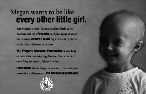 Megan wants to be like  every other little girl. But Megan is not like most other little girls because she has Progeria, a rapid aging disease that causes children to die by their early teens