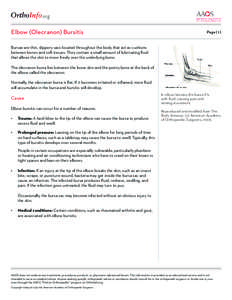 Bursae / Soft tissue disorders / Olecranon bursitis / Bursitis / Synovial bursa / Arthritis / American Academy of Orthopaedic Surgeons / Elbow / Orthopedic surgery / Anatomy / Medicine / Health