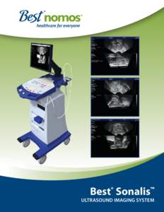 Best Sonalis ® ™  Ultrasound Imaging System