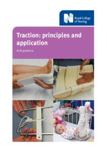 Traction: principles and application RCN guidance The RCN Society of Orthopaedic and Trauma Nursing (SOTN) Expert Traction Reference Group