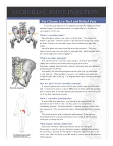 sacroiliac Joint inJection For Chronic Low Back and Buttock Pain A sacroiliac joint injection is an outpatient procedure for treating low back and buttock pain. This information sheet will explain what it is. Your doctor