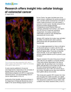 Research offers insight into cellular biology of colorectal cancer