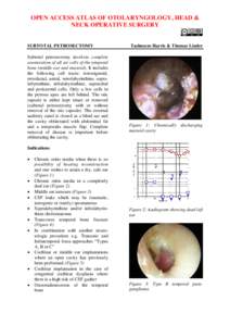 OPEN ACCESS ATLAS OF OTOLARYNGOLOGY, HEAD & NECK OPERATIVE SURGERY SUBTOTAL PETROSECTOMY Subtotal petrosectomy involves complete exenteration of all air cells of the temporal