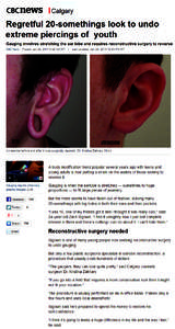 eBenews ICalgary Regretful 20-somethings look to undo extreme piercings of youth Gauging involves stretching the ear lobe and requires reconstructive surgery t o reverse CDC _ Pmted, Ja