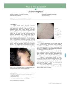 Biology / Triangular alopecia / Baldness / Cicatricial alopecia / Noncicatricial alopecia / Dermatoscopy / Tinea capitis / Human hair growth / Trichoscopy / Medicine / Health / Alopecia