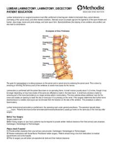 LUMBAR LAMINECTOMY, LAMINOTOMY, DISCECTOMY PATIENT EDUCATION Lumbar laminectomy is a surgical procedure most often performed to treat leg pain related to herniated discs, spinal stenosis (narrowing of the spinal canal), 