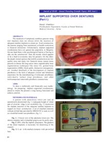 Journal of IMAB - Annual Proceeding (Scientific Papers) 2009, book 2  IMPLANT SUPPORTED OVER DENTURES (Part I ) Metodi Abadzhiev Prosthodontic Department, Faculty of Dental Medicine,
