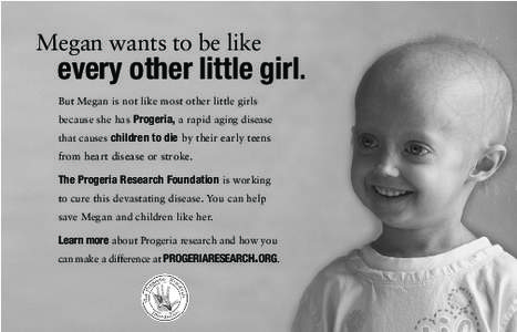 Megan wants to be like  every other little girl. But Megan is not like most other little girls because she has Progeria, a rapid aging disease that causes children to die by their early teens