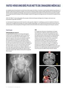 FAITES-VOUS UNE IDÉE PLUS NETTE DE L’IMAGERIE MÉDICALE Les maladies peuvent se présenter sous des formes et des aspects très divers, et certaines sont plus faciles à détecter que d’autres. Si des lésions telle