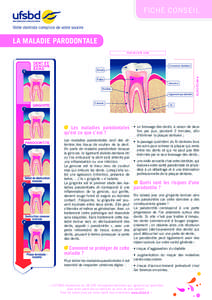 FICHE CONSEIL Votre dentiste complice de votre sourire LA MALADIE PARODONTALE PARODONTE SAIN