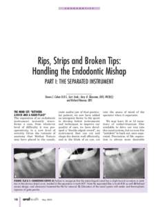 Pulp / Root canal / Dentin / Tooth / Crown / Commonly used terms of relationship and comparison in dentistry / Endodontic files and reamers / Dentistry / Endodontics / Endodontic therapy