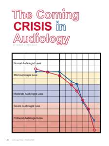 By Ba r ry A. Fr eem a n  Normal Audiologist Level Mild Audiologist Loss