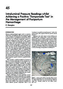 45 Intraluminal Pressure Readings whilst Achieving a Positive ‘Tamponade Test’ in the Management of Postpartum Hemorrhage C. Georgiou