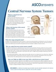 Central Nervous System Tumors A central nervous system (CNS) tumor occurs when healthy cells in the brain or spinal cord change and grow uncontrollably, forming a mass. A CNS tumor can be noncancerous or cancerous. The f