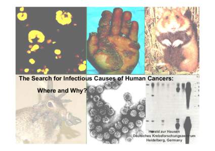 The Search for Infectious Causes of Human Cancers: Where and Why? Harald zur Hausen Deutsches Krebsforschungszentrum Heidelberg, Germany