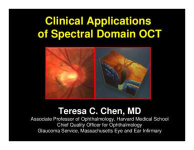 Laser medicine / Medical equipment / Optical coherence tomography / Glaucoma / Health / Medicine / Optical imaging / Optics