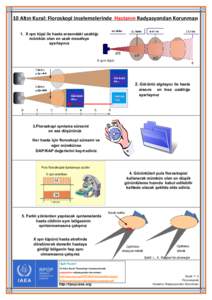 10 Altın Kural: Floroskopi incelemelerinde Hastanın Radyasyondan Korunması 1. X ışın tüpü ile hasta arasındaki uzaklığı mümkün olan en uzak mesafeye ayarlayınız  X ışını tüpü