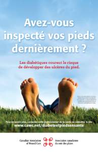 Avez-vous inspecté vos pieds dernièrement ? Les diabétiques courent le risque de développer des ulcères du pied.