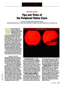 Optometry / Visual system / Retina / Ophthalmoscopy / Lattice degeneration / Contact lens / Posterior vitreous detachment / Floater / Slit lamp / Ophthalmology / Medicine / Vision