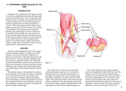 11. PERIPHERAL NERVE BLOCKS OF THE ARM INTRODUCTION Peripheral nerve blockade of the upper extremity is often accomplished with proximal approaches to the brachial plexus (C5–T1) via supraclavicular, infraclavicular, o