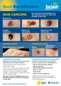 Spot the difference SKIN CANCERS Melanoma Nodular melanoma