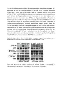 ZFP36 (zinc finger protein 36)-Proteine regulieren die Stabilität spezifischer Transkripte, insbesondere der TNF-  Tumornekrosefaktor- - (Vascular endothelial