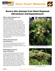 Toxic Plant Warning Severe skin damage from Giant Hogweed (Heracleum mantegazzianum) What is Giant Hogweed, and where is it found?