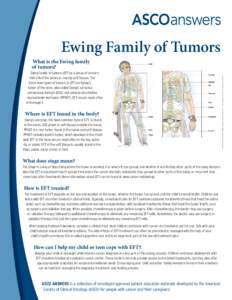 Oncology / Anatomical pathology / Management of cancer / Radiation therapy / Metastasis / Chemotherapy / Ewing sarcoma / Ewing family of tumors / Cancer / Medicine / Sarcoma / Cancer treatments