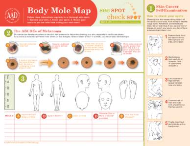 1  Body Mole Map How to check your spots: