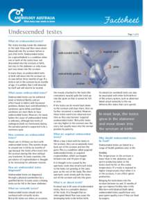 Factsheet	 Undescended testes Page 1 of 2  What are undescended testes?