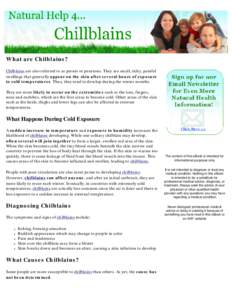 Natural Help for Chillblains
