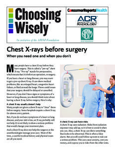 ®  Chest X-rays before surgery When you need one and when you don’t  M