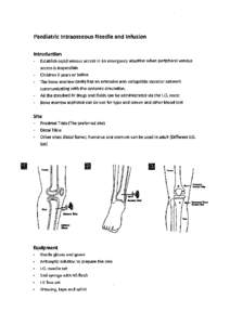 Paediatric lntraosseous Needle and Infusion Introduction Establish rapid venous access in an emergency situation when peripheral venous access is impossible Children 6 years or below The bone marrow cavity has an extensi