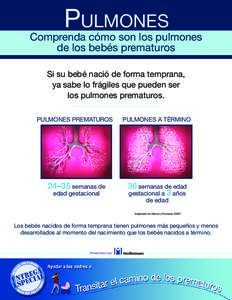 Pulmones  Comprenda cómo son los pulmones de los bebés prematuros Si su bebé nació de forma temprana, ya sabe lo frágiles que pueden ser