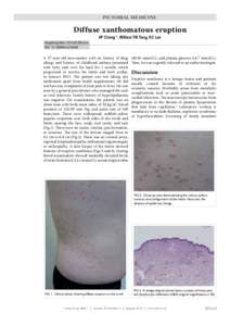 PICTORIAL MEDICINE  Diffuse xanthomatous eruption HF Cheng *, William YM Tang, KC Lee  Hong Kong Med J 2014;20:350.e3-4