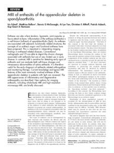 1553  REVIEW MRI of enthesitis of the appendicular skeleton in spondyloarthritis