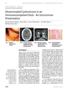 60	  Journal of the association of physicians of india • vol 62 • published on 1st of every month 1st june, 2014 PICTORIAL CME’s