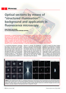 Microscopy  Optical sections by means of