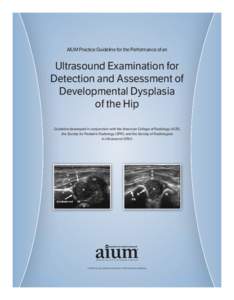 Developmental Dysplasia of the Hip_0613[removed]:24 PM Page 1  AIUM Practice Guideline for the Performance of an Ultrasound Examination for Detection and Assessment of