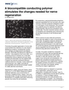 A biocompatible conducting polymer stimulates the changes needed for nerve regeneration