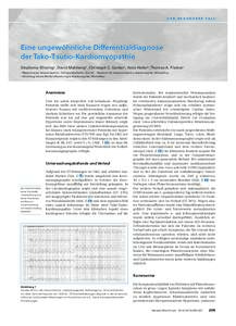 D E R B E S O N D E R E FA L L  Eine ungewöhnliche Differentialdiagnose der Tako-Tsubo-Kardiomyopathie Stephanie Klinzinga, David Mahlbergb, Christoph C. Gantera, Alois Hallerb, Thomas A. Fischerc a