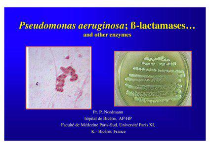 Pseudomonas aeruginosa; ß-lactamases… and other enzymes
