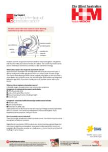 FACTSHEET  Early detection of prostate cancer Prostate cancer