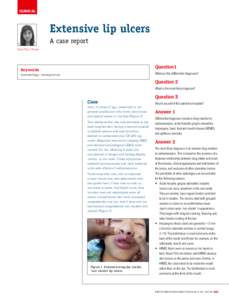 Drug eruptions / Erythema multiforme / Syndromes / Aphthous ulcer / Mouth ulcer / Stevens–Johnson syndrome / Carbamazepine / Mucositis / Erythema / Medicine / Health / Oral pathology