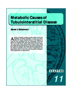 Nephrocalcinosis / Distal renal tubular acidosis / Primary hyperoxaluria / Renal tubular acidosis / Hyperuricosuria / Hyperuricemia / Tumor lysis syndrome / Bartter syndrome / Hyperoxaluria / Medicine / Health / Kidney diseases