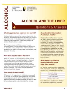 ALCOHOL  ALCOHOL AND THE LIVER +